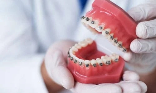 Mirage Dental Clinic | Orthodontics