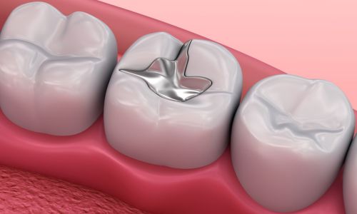 Mirage Dental Clinic | Restorative Dentistry