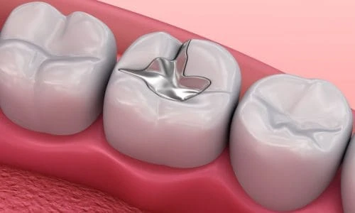 Mirage Dental Clinic | Restorative Dentistry